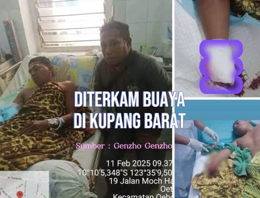 Pergelangan Tangan Kanan Petani di Kupang Putus Setelah Diterkam Buaya Saat Mencari Ikan